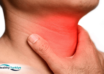 The Role of Tonsillectomy in Treating Sleep Apnea