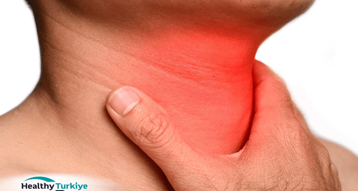 The Role of Tonsillectomy in Treating Sleep Apnea